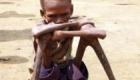 A Starving Child In Haiti